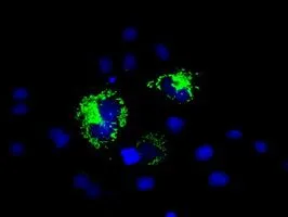 ICC/IF analysis of COS7 cells transiently transfected with MTRF1L plasmid using GTX84071 MTRF1L antibody [1B3].