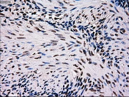 IHC-P analysis of human endometrium tissue using GTX84086 MRI1 antibody [6A10]. Antigen retrieval : Heat-induced epitope retrieval by 10mM citrate buffer, pH6.0, 100oC for 10min.