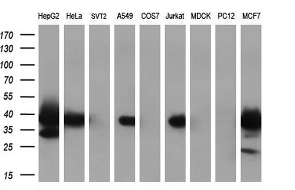 WB analysis of various cell lines using GTX84086 MRI1 antibody [6A10]. Loading : 35 ug per lane Dilution : 1:200