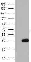 WB analysis of HEK293T cells transfected with MOBKL2B plasmid (Right) or empty vector (Left) for 48 hrs using GTX84092 MOBKL2B antibody [2H8]. Loading : 5 ug per lane