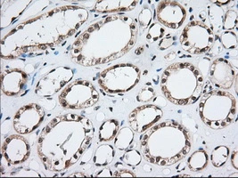 IHC-P analysis of human kidney tissue using GTX84103 MOB1B antibody [3G9]. Antigen retrieval : Heat-induced epitope retrieval by 10mM citrate buffer, pH6.0, 100oC for 10min. Dilution : 1:50
