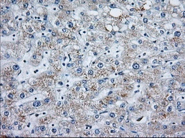 IHC-P analysis of human liver tissue using GTX84103 MOB1B antibody [3G9]. Antigen retrieval : Heat-induced epitope retrieval by 10mM citrate buffer, pH6.0, 100oC for 10min. Dilution : 1:50