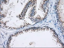 IHC-P analysis of human prostate tissue using GTX84103 MOB1B antibody [3G9]. Antigen retrieval : Heat-induced epitope retrieval by 10mM citrate buffer, pH6.0, 100oC for 10min. Dilution : 1:50