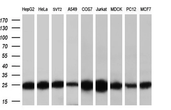 WB analysis of HEK293T cells transfected with MOB1B plasmid (Right) or empty vector (Left) for 48 hrs using GTX84103 MOB1B antibody [3G9]. Loading : 5 ug per lane