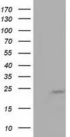 WB analysis of HEK293T cells transfected with MOB1B plasmid (Right) or empty vector (Left) for 48 hrs using GTX84103 MOB1B antibody [3G9]. Loading : 5 ug per lane