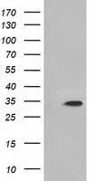 WB analysis of HEK293T cells transfected with MIOX plasmid (Right) or empty vector (Left) for 48 hrs using GTX84112 MIOX antibody [1C5]. Loading : 5 ug per lane