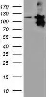WB analysis of HEK293T cells transfected with MICAL1 plasmid (Right) or empty vector (Left) for 48 hrs using GTX84126 MICAL1 antibody [6H10]. Loading : 5 ug per lane