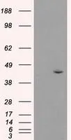 WB analysis of HEK293T cells transfected with JNK1 plasmid (Right) or empty vector (Left) for 48 hrs using GTX84145 JNK1 antibody [2C6]. Loading : 5 ug per lane
