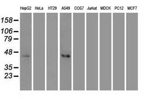 WB analysis of various cell lines using GTX84145 JNK1 antibody [2C6]. Loading : 35 ug per lane