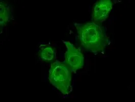 ICC/IF analysis of COS7 cells transiently transfected with p38 beta plasmid using GTX84149 p38 beta antibody [1C2].