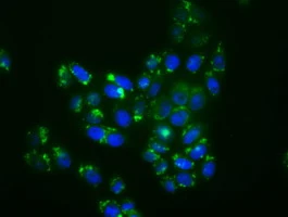 ICC/IF analysis of HeLa cells using GTX84149 p38 beta antibody [1C2].