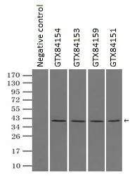 IP analysis of DDDDK tagged ERK2 overexpressed HEK293T lysate using GTX84151 ERK2 antibody [4C2].After extensive wash to remove any non-specific binding, the immuno-precipitated products were analyzed with rabbit anti-DDDDK polyclonal antibody. IP reaction : 2microg antibody / 500microl cell lysate