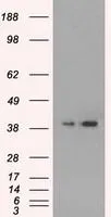 WB analysis of HEK293T cells transfected with ERK2 plasmid (Right) or empty vector (Left) for 48 hrs using GTX84151 ERK2 antibody [4C2]. Loading : 5 ug per lane
