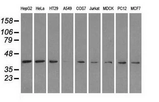 WB analysis of various cell lines using GTX84151 ERK2 antibody [4C2]. Loading : 35 ug per lane