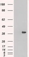 WB analysis of HEK293T cells transfected with ERK2 plasmid (Right) or empty vector (Left) for 48 hrs using GTX84153 ERK2 antibody [4D10]. Loading : 5 ug per lane