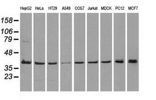 WB analysis of various cell lines using GTX84153 ERK2 antibody [4D10]. Loading : 35 ug per lane