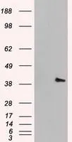 WB analysis of HEK293T cells transfected with ERK2 plasmid (Right) or empty vector (Left) for 48 hrs using GTX84154 ERK2 antibody [6F8]. Loading : 5 ug per lane