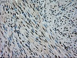 IHC-P analysis of endometrium tissue using GTX84159 ERK2 antibody [6E5]. Antigen retrieval : Heat-induced epitope retrieval by 10mM citrate buffer, pH6.0, 100oC for 10min. Dilution : 1:50