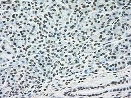 IHC-P analysis of pancreas tissue using GTX84159 ERK2 antibody [6E5]. Antigen retrieval : Heat-induced epitope retrieval by 10mM citrate buffer, pH6.0, 100oC for 10min. Dilution : 1:50