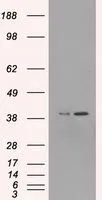 WB analysis of HEK293T cells transfected with ERK2 plasmid (Right) or empty vector (Left) for 48 hrs using GTX84159 ERK2 antibody [6E5]. Loading : 5 ug per lane