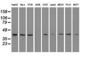 WB analysis of various cell lines using GTX84159 ERK2 antibody [6E5]. Loading : 35 ug per lane