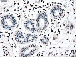 IHC-P analysis of human breast tissue using GTX84165 MEK2 antibody [8G6]. Antigen retrieval : Heat-induced epitope retrieval by 10mM citrate buffer, pH6.0, 100oC for 10min.