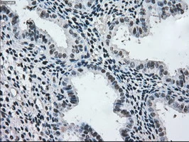 IHC-P analysis of human endometrium tissue using GTX84165 MEK2 antibody [8G6]. Antigen retrieval : Heat-induced epitope retrieval by 10mM citrate buffer, pH6.0, 100oC for 10min.