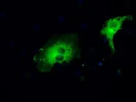 ICC/IF analysis of COS7 cells transiently transfected with MEK1 plasmid using GTX84168 MEK1 antibody [1C1].