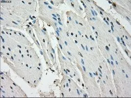 IHC-P analysis of bladder tissue using GTX84170 LTA4H antibody [1E9]. Antigen retrieval : Heat-induced epitope retrieval by 10mM citrate buffer, pH6.0, 100oC for 10min. Dilution : 1:50