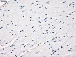 IHC-P analysis of colon tissue using GTX84170 LTA4H antibody [1E9]. Antigen retrieval : Heat-induced epitope retrieval by 10mM citrate buffer, pH6.0, 100oC for 10min. Dilution : 1:50