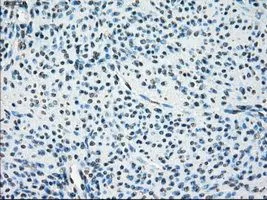 IHC-P analysis of endometrium tissue using GTX84170 LTA4H antibody [1E9]. Antigen retrieval : Heat-induced epitope retrieval by 10mM citrate buffer, pH6.0, 100oC for 10min. Dilution : 1:50