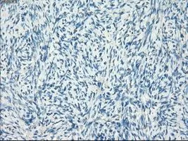 IHC-P analysis of ovary tissue using GTX84170 LTA4H antibody [1E9]. Antigen retrieval : Heat-induced epitope retrieval by 10mM citrate buffer, pH6.0, 100oC for 10min. Dilution : 1:50