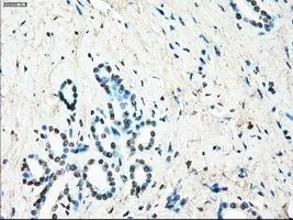 IHC-P analysis of pancreas tissue using GTX84170 LTA4H antibody [1E9]. Antigen retrieval : Heat-induced epitope retrieval by 10mM citrate buffer, pH6.0, 100oC for 10min. Dilution : 1:50