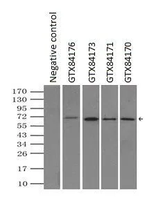 IP analysis of DDDDK tagged LTA4H overexpressed HEK293T lysate using GTX84170 LTA4H antibody [1E9].After extensive wash to remove any non-specific binding, the immuno-precipitated products were analyzed with rabbit anti-DDDDK polyclonal antibody. IP reaction : 2microg antibody / 500microl cell lysate