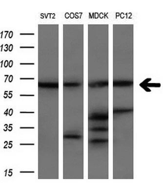 WB analysis of various cell lines using GTX84173 LTA4H antibody [6B5]. Loading : 10 ug per lane Dilution : 1:200