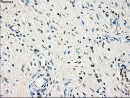 IHC-P analysis of prostate tissue using GTX84176 LTA4H antibody [9C5]. Antigen retrieval : Heat-induced epitope retrieval by 10mM citrate buffer, pH6.0, 100oC for 10min. Dilution : 1:50