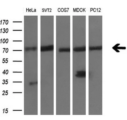 WB analysis of various cell lines using GTX84176 LTA4H antibody [9C5]. Loading : 10 ug per lane Dilution : 1:200