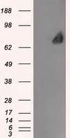 WB analysis of HEK293T cells transfected with LTA4H plasmid (Right) or empty vector (Left) for 48 hrs using GTX84176 LTA4H antibody [9C5]. Loading : 5 ug per lane