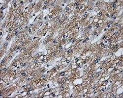 IHC-P analysis of human liver tissue using GTX84191 Endothelial Lipase / LIPG antibody [4A8]. Antigen retrieval : Heat-induced epitope retrieval by 10mM citrate buffer, pH6.0, 100oC for 10min.