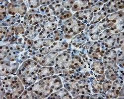 IHC-P analysis of human pancreas tissue using GTX84191 Endothelial Lipase / LIPG antibody [4A8]. Antigen retrieval : Heat-induced epitope retrieval by 10mM citrate buffer, pH6.0, 100oC for 10min.