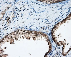 IHC-P analysis of human prostate tissue using GTX84191 Endothelial Lipase / LIPG antibody [4A8]. Antigen retrieval : Heat-induced epitope retrieval by 10mM citrate buffer, pH6.0, 100oC for 10min.