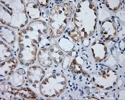 IHC-P analysis of human kidney tissue using GTX84195 Endothelial Lipase / LIPG antibody [2A5]. Antigen retrieval : Heat-induced epitope retrieval by 10mM citrate buffer, pH6.0, 100oC for 10min.