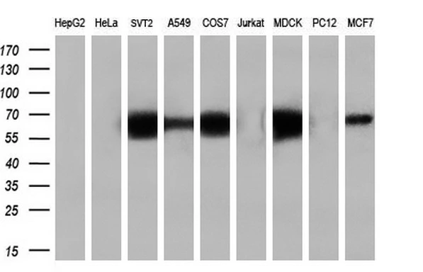 WB analysis of various cell lines using GTX84195 Endothelial Lipase / LIPG antibody [2A5]. Loading : 35 ug per lane Dilution : 1:200