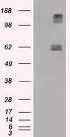 WB analysis of HEK293T cells transfected with Endothelial Lipase / LIPG plasmid (Right) or empty vector (Left) for 48 hrs using GTX84195 Endothelial Lipase / LIPG antibody [2A5]. Loading : 5 ug per lane