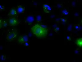 ICC/IF analysis of COS7 cells transiently transfected with Endothelial Lipase / LIPG plasmid using GTX84195 Endothelial Lipase / LIPG antibody [2A5].