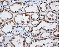 IHC-P analysis of human kidney tissue using GTX84209 Endothelial Lipase / LIPG antibody [1B8]. Antigen retrieval : Heat-induced epitope retrieval by 10mM citrate buffer, pH6.0, 100oC for 10min.