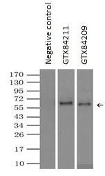 IP analysis of DDDDK tagged Endothelial Lipase / LIPG overexpressed HEK293T lysate using GTX84209 Endothelial Lipase / LIPG antibody [1B8].After extensive wash to remove any non-specific binding, the immuno-precipitated products were analyzed with rabbit anti-DDDDK polyclonal antibody. IP reaction : 2microg antibody / 500microl cell lysate