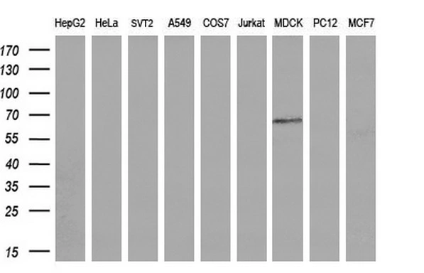 WB analysis of various cell lines using GTX84209 Endothelial Lipase / LIPG antibody [1B8]. Loading : 35 ug per lane Dilution : 1:200
