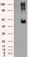 WB analysis of HEK293T cells transfected with Endothelial Lipase / LIPG plasmid (Right) or empty vector (Left) for 48 hrs using GTX84209 Endothelial Lipase / LIPG antibody [1B8]. Loading : 5 ug per lane