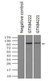 IP analysis of DDDDK tagged LEMD3 overexpressed HEK293T lysate using GTX84222 LEMD3 antibody [3H2].After extensive wash to remove any non-specific binding, the immuno-precipitated products were analyzed with rabbit anti-DDDDK polyclonal antibody. IP reaction : 2microg antibody / 500microl cell lysate